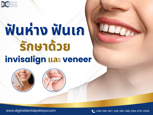 ฟันห่าง ฟันเก รักษาด้วย invisalign และ veneer