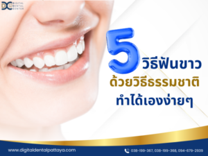 ภาพรอยยิ้มของผู้หญิงที่มีฟันขาวสะอาด พร้อมข้อความ '5 วิธีฟันขาวด้วยวิธีธรรมชาติ ทำได้เองง่ายๆ' บนพื้นหลังสีขาวที่มีรายละเอียดการติดต่อของ Digital Dental Center