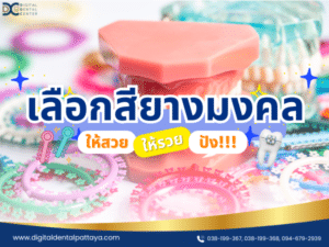 เลือกสียางมงคลสำหรับการจัดฟัน ให้สวยและปัง ที่ Digital Dental Center พัทยา