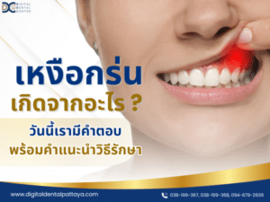 เหงือกร่นเกิดจากอะไร? พร้อมคำแนะนำวิธีรักษา - Digital Dental Center พัทยา