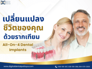 เปลี่ยนแปลงชีวิตด้วยรากฟันเทียม All-on-4 - Digital Dental Center พัทยา