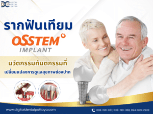 รากฟันเทียม Osstem Implant นวัตกรรมทันตกรรมที่เปลี่ยนแปลงการดูแลสุขภาพช่องปาก