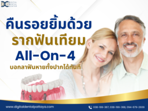 คืนรอยยิ้มด้วย รากฟันเทียม All On 4 บอกลาฟันหายทั้งปากได้ทันที