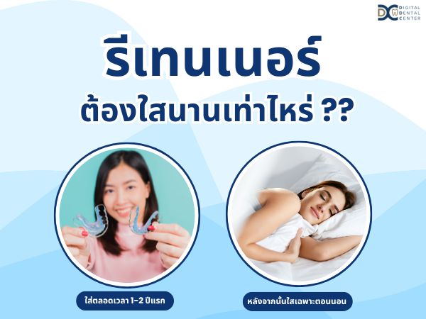 จัดฟันรอบสอง, Digital Dental Center Pattaya, คลินิกทันตกรรม, จัดฟันใส, รอยยิ้มสวย, ฟันสวย