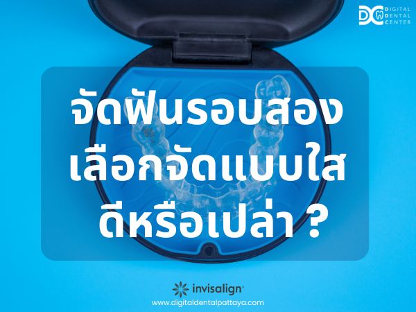 จัดฟันรอบสอง, Digital Dental Center Pattaya, คลินิกทันตกรรม, จัดฟันใส, รอยยิ้มสวย, ฟันสวย