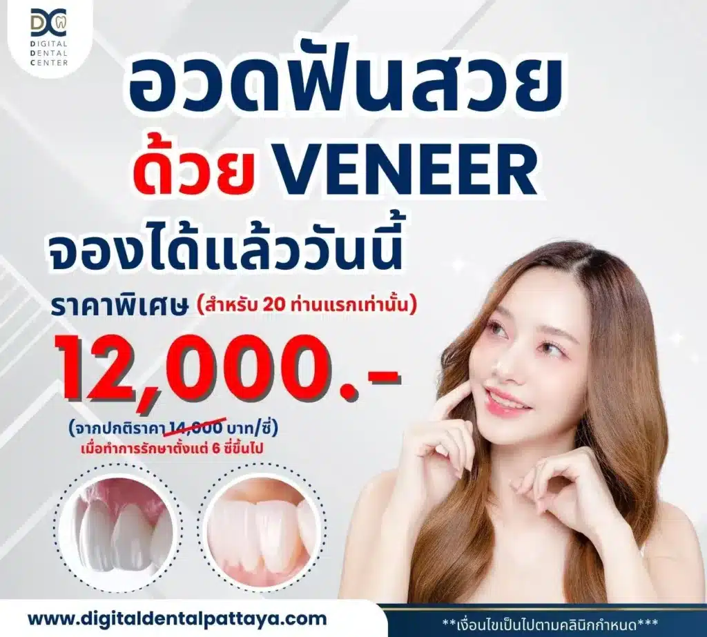 โปรโมชั่น วีเนียร์ digital dental center pattaya