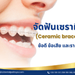 รูปภาพของคนไข้ที่กำลังยิ้มพร้อมติดเครื่องมือจัดฟันเซรามิก (Ceramic braces) ที่มองเห็นได้น้อยและกลมกลืนกับสีฟัน พร้อมข้อความ "จัดฟันเซรามิก (Ceramic braces) ข้อดี ข้อเสีย และราคา" จาก Digital Dental Center Pattaya