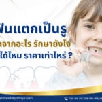 ฟันแตกเป็นรู เกิดจากอะไร รักษายังไง อุดได้ไหม ราคาเท่าไหร่ ?