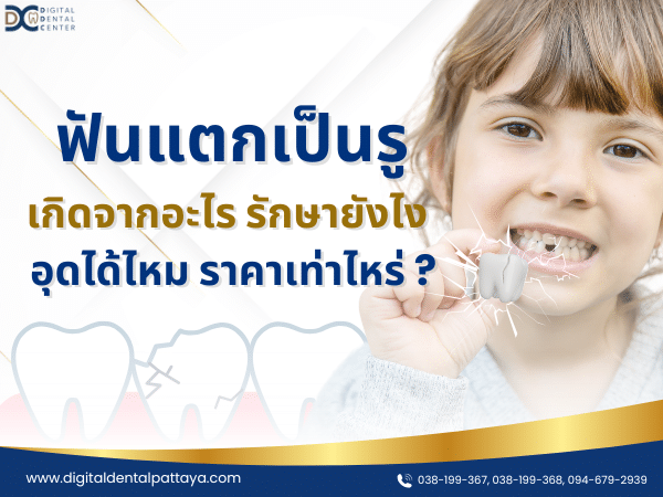 ฟันแตกเป็นรู เกิดจากอะไร รักษายังไง อุดได้ไหม ราคาเท่าไหร่ ?