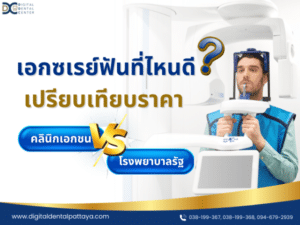 เปรียบเทียบราคาเอกซเรย์ฟัน คลินิกเอกชน VS โรงพยาบาลรัฐ พร้อมคำแนะนำจาก Digital Dental Center Pattaya"