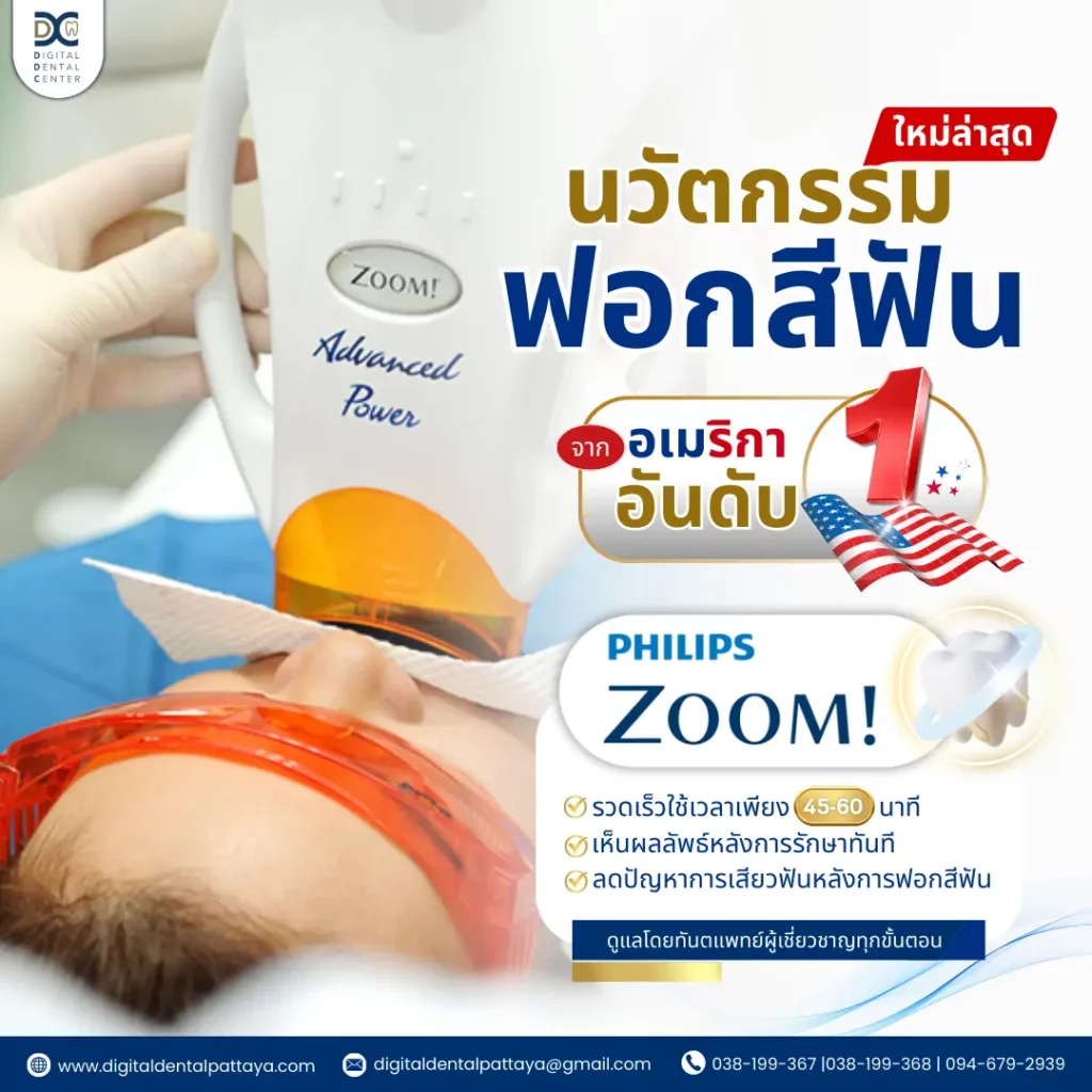 Zoom teeth whitening นวัตกรรมฟอกสีฟัน