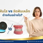 จัดฟันใสกับจัดฟันเหล็ก แบบไหนดีกว่ากัน ดูข้อแตกต่างที่นี่